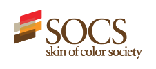 SOCS
